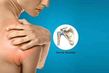 Shoulder Pain Treatment