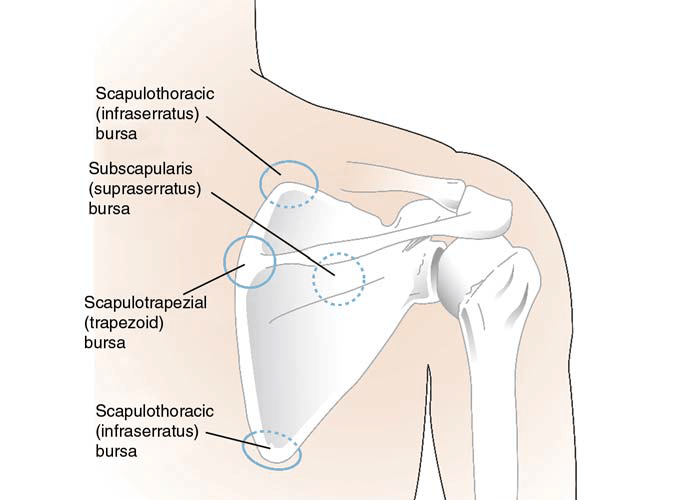 Snapping Scapula