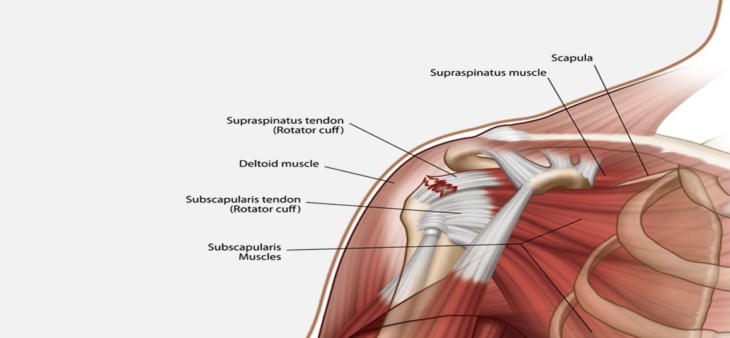 Can Rotator Cuff Injuries heal by itself?